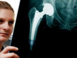 Metal kalça protezleri daha riskli